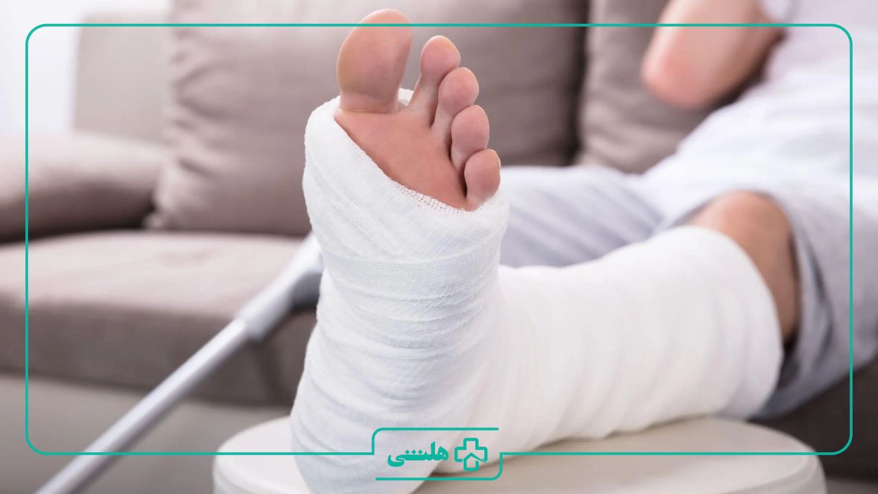 مراقبت های بعد از باز كردن گچ پا+ نکات مهم | هلثی